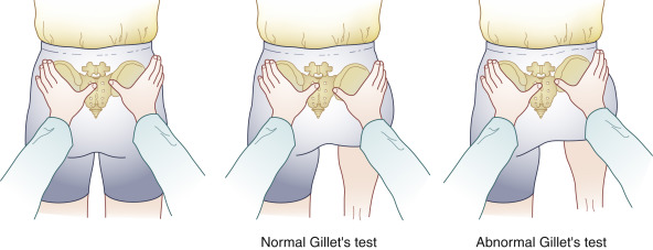 Gillette test 