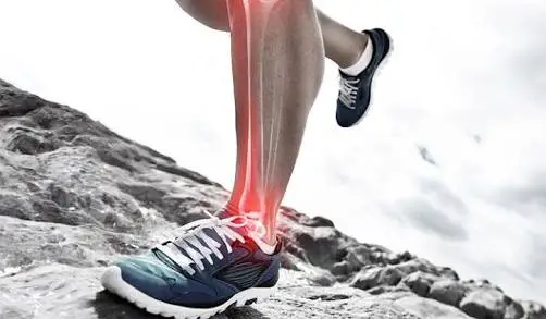 Medial Tibial Stress Syndrome (MTSS)