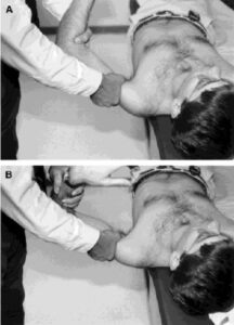 Load Shift R Test Load and Shift test for the shoulder : - Mobile Physiotherapy Clinic