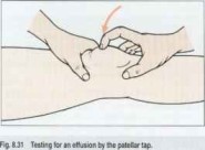 Patellar tap test