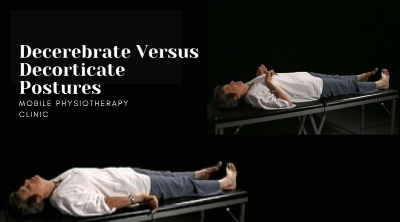 Decerebrate Versus Decorticate Postures