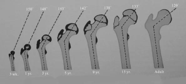 MEAN ANGLE OF THE FEMORAL NECK SHAFT IN DIFFERENT AGE GROUP