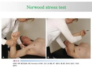 Norwood stress test