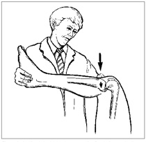Posterior sag sign of the knee joint