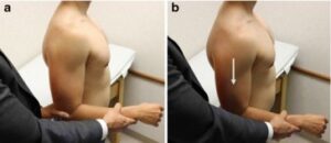 Sulcus sign of the shoulder : - Mobile Physiotherapy Clinic