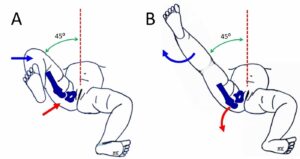 Special test for the hip pathology in pediatric: - Mobile Physiotherapy ...