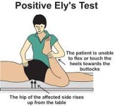 Ely’s test