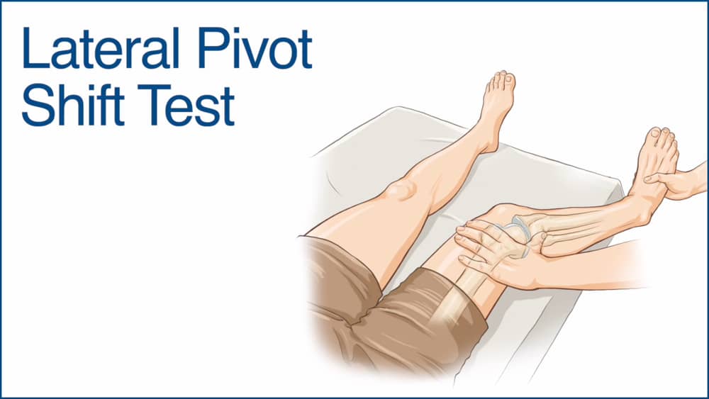 lateral Pivot shift test