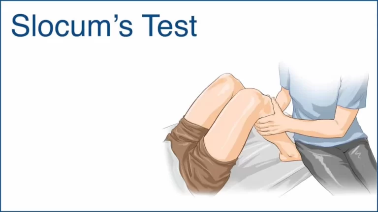 Slocum test of the Knee: Purpose, How to Perform?