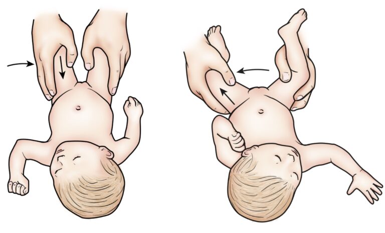 Special test for the hip pathology in pediatric: