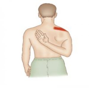 Supraspinatus stretch: Health benefits and how to do ?