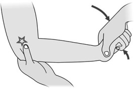 Cozen’s Test of the elbow joint