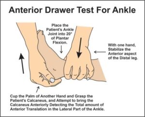 Anterior Drawer of the Ankle: - Mobile Physiotherapy Clinic