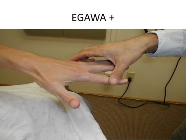 Egawa's sign