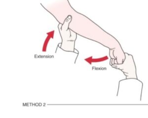 Mill’s Test of the elbow joint: - Mobile Physiotherapy Clinic