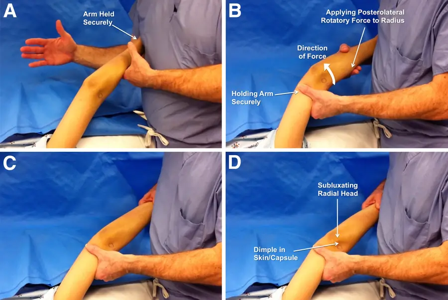 Posterolateral rotary apprehension test