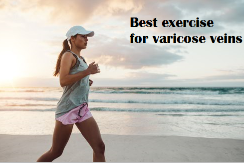 Exercise for varicose vein