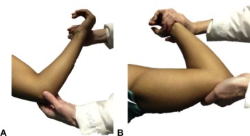 Plica impingement test of elbow