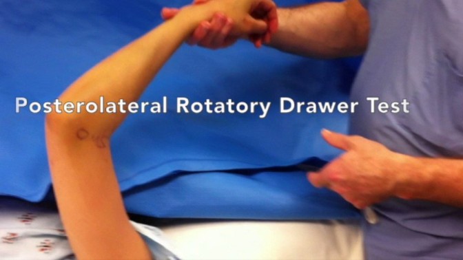 Posterolateral rotary drawer test