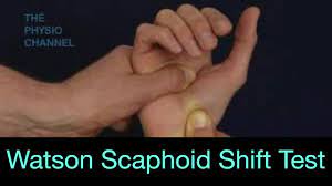 Scaphoid shift test: