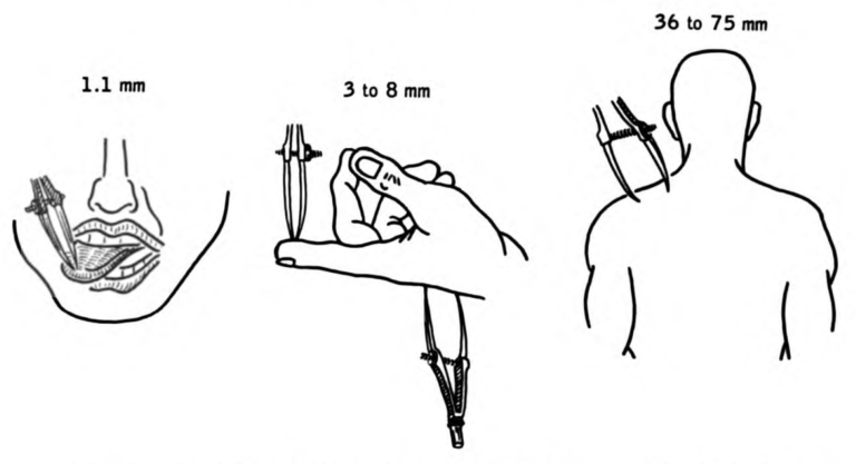 weber-two-point-discrimination-test-mobile-physiotherapy-clinic