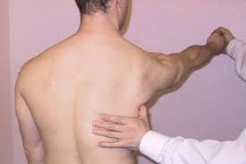 Serratus anterior weakness test of the shoulder: