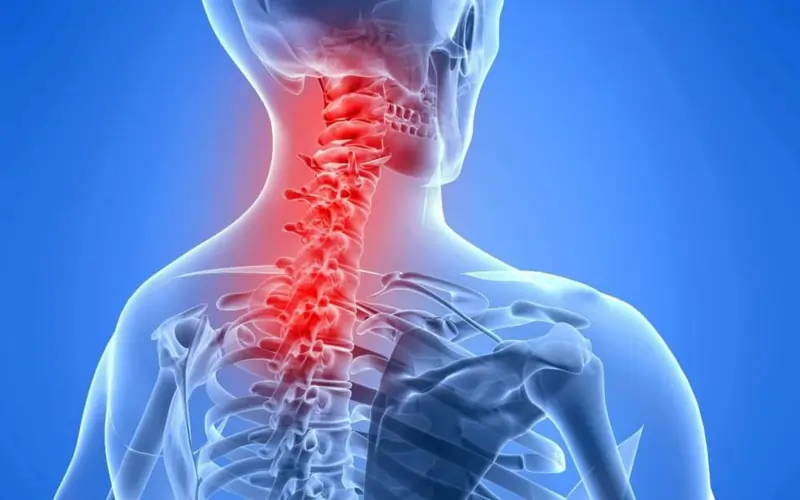 Neck pain