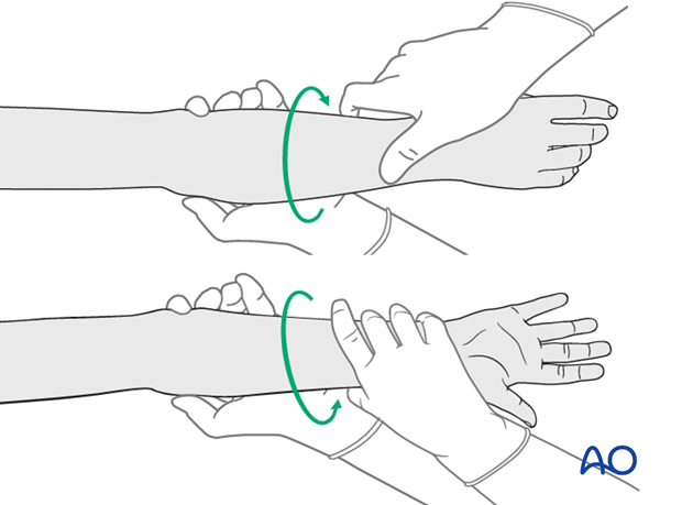 Passive Forearm Rotations