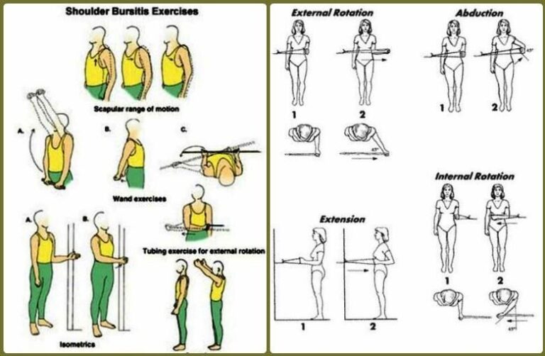 Shoulder Exercises for Bursitis