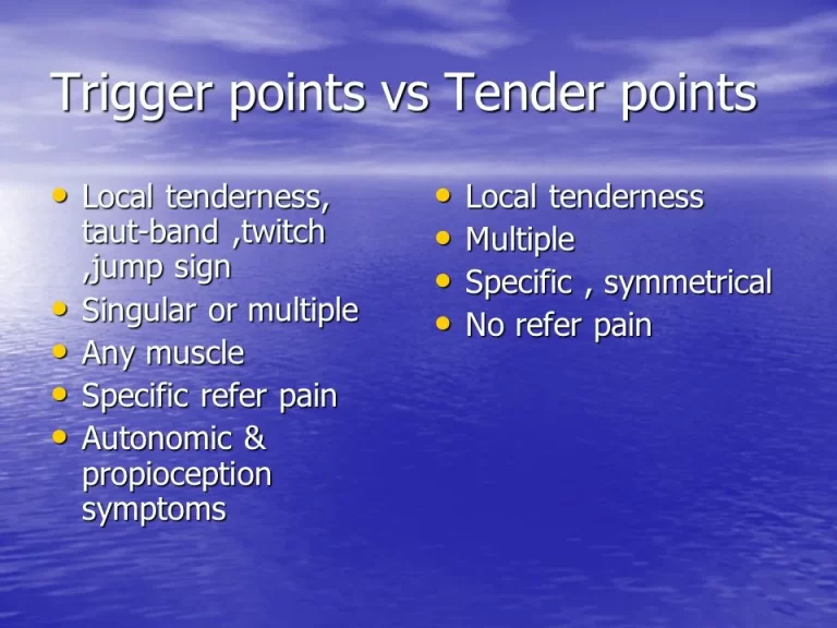 The Difference Between Trigger point and Tender point