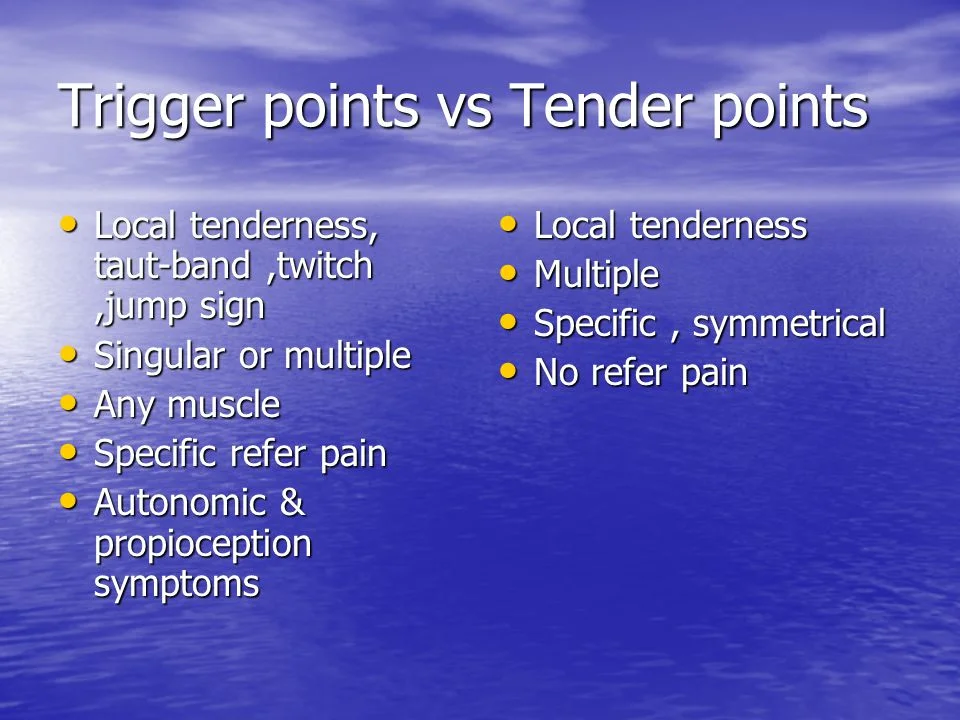 trigger point vs tender point