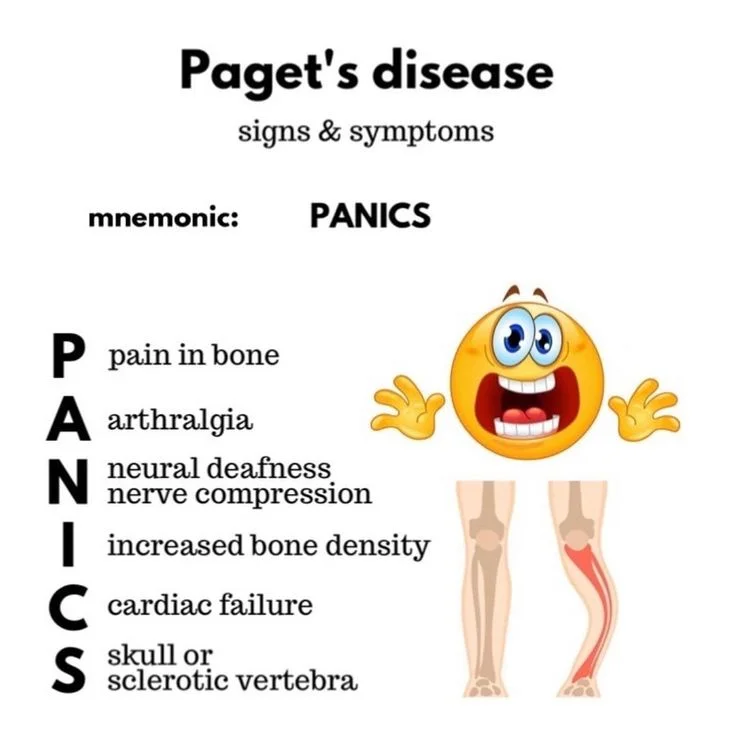 Paget’s Disease of the Bone
