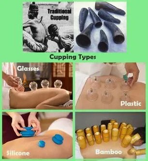 Types of cups