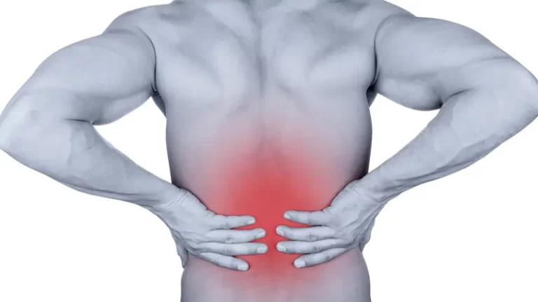 Lumbar Strain