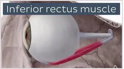 Inferior Rectus Muscle