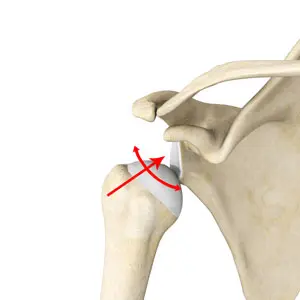Multidirectional shoulder instability