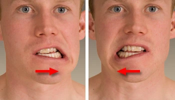 side-to-side-jaw-movement
