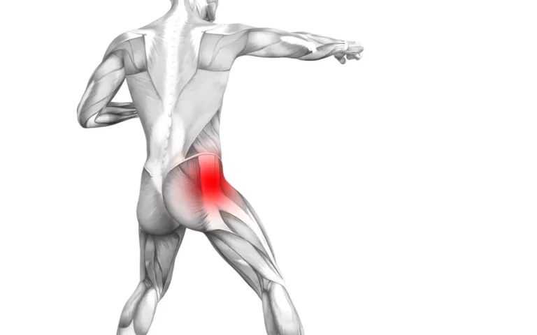 Piriformis Muscle Pain