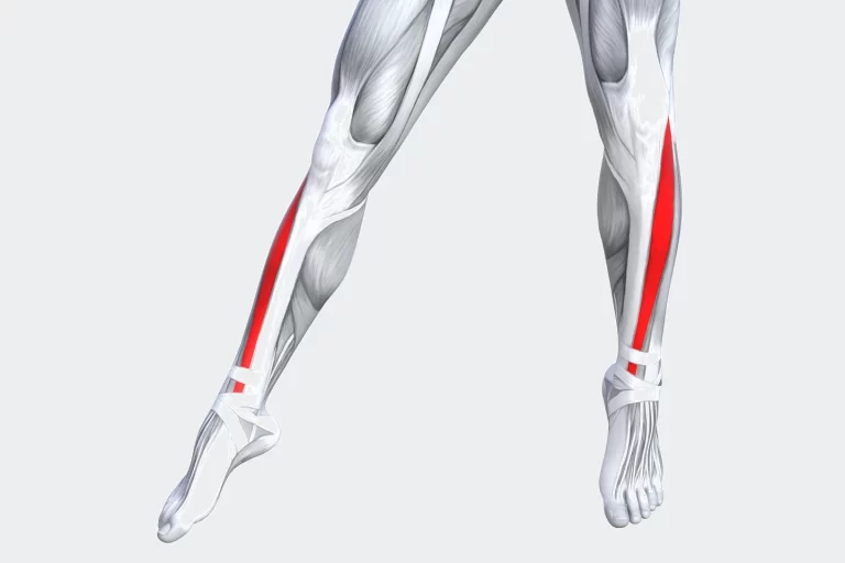 Tibialis Anterior Muscle Pain