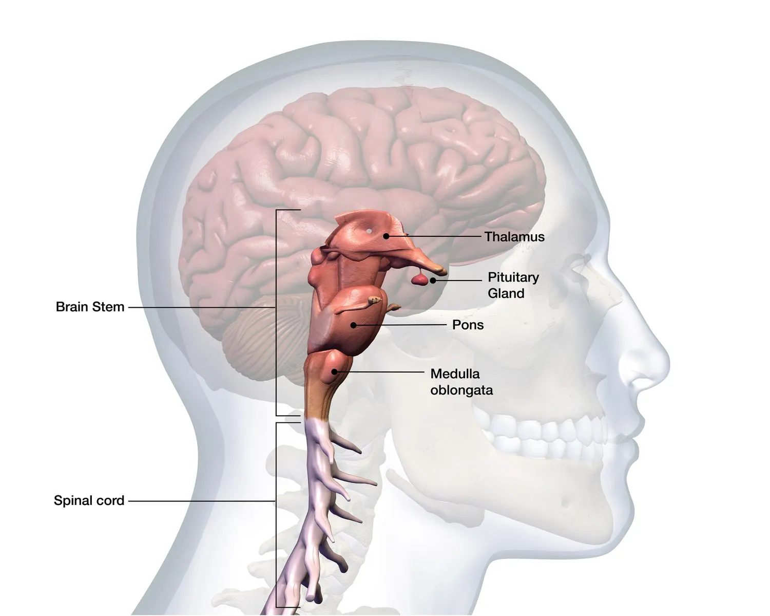 brainstem-stroke