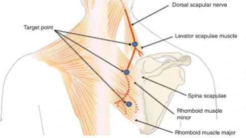 dorsal scapular nerve cadaver
