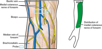 Medial cutaneous nerve of the forearm