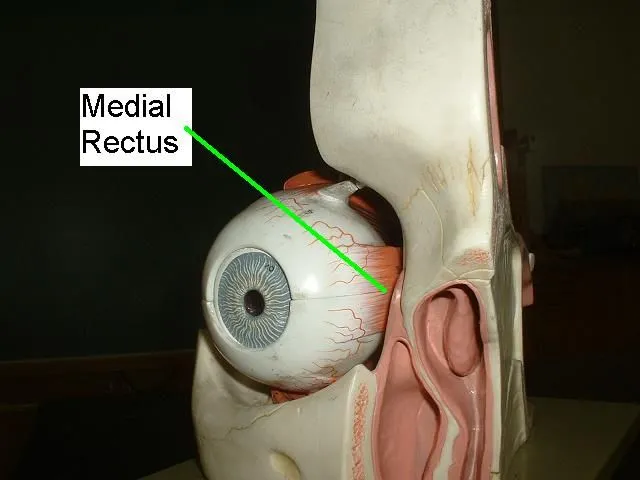 Medial Rectus Muscle