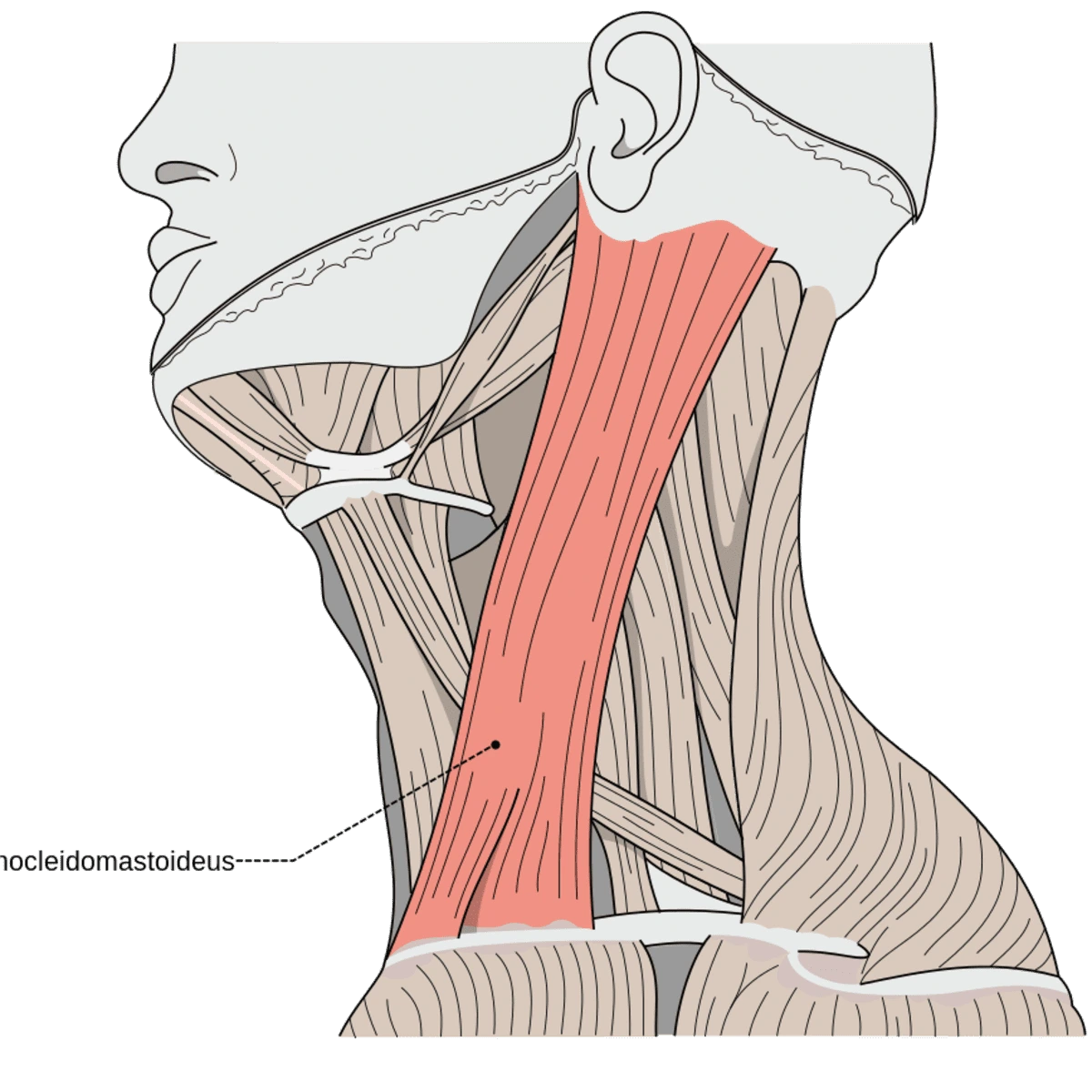 sternocleidomastoid muscle swelling