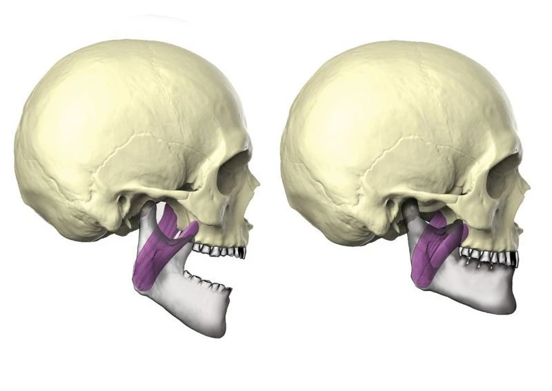 Medial pterygoid action