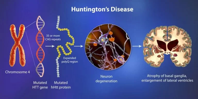 Huntington’s disease (HD)