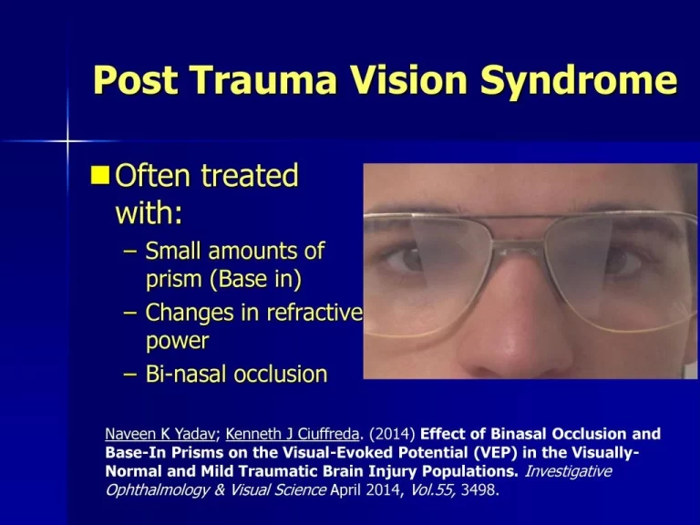 Post-Traumatic Vision Syndrome