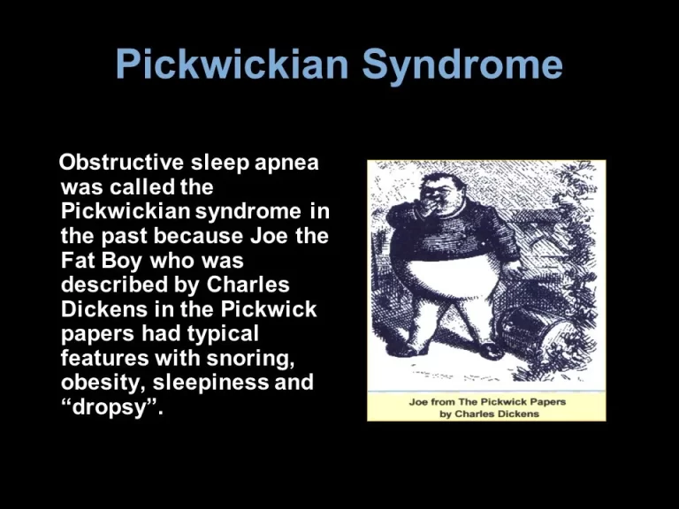 Pickwickian syndrome