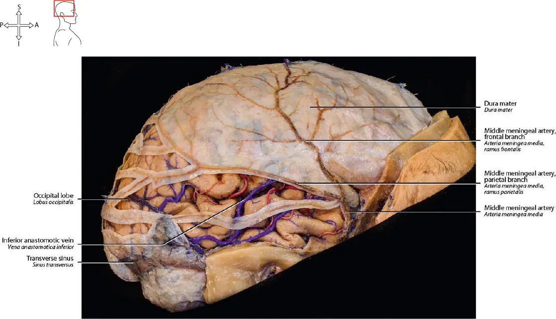 Meninges of the brain