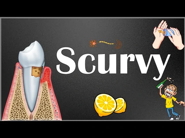 Scurvy